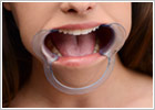 Dilatatore da bocca in plastica Cheek Retractor Dental Mouth Gag